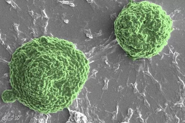  روش جدید درمان سرطان کشف شد ؛ میکروربات های جلبکی با تولید اکسیژن تودههای سرطانی را نابود میکنند
