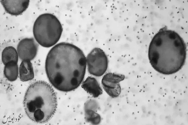  روش جدید درمان سرطان کشف شد ؛ میکروربات های جلبکی با تولید اکسیژن تودههای سرطانی را نابود میکنند