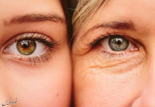 موثرترین روش های درمان خانگی افتادگی پلک | مراقبت از چشم