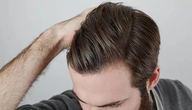 نکات و اصول اولیه مراقبت از مو در مردان