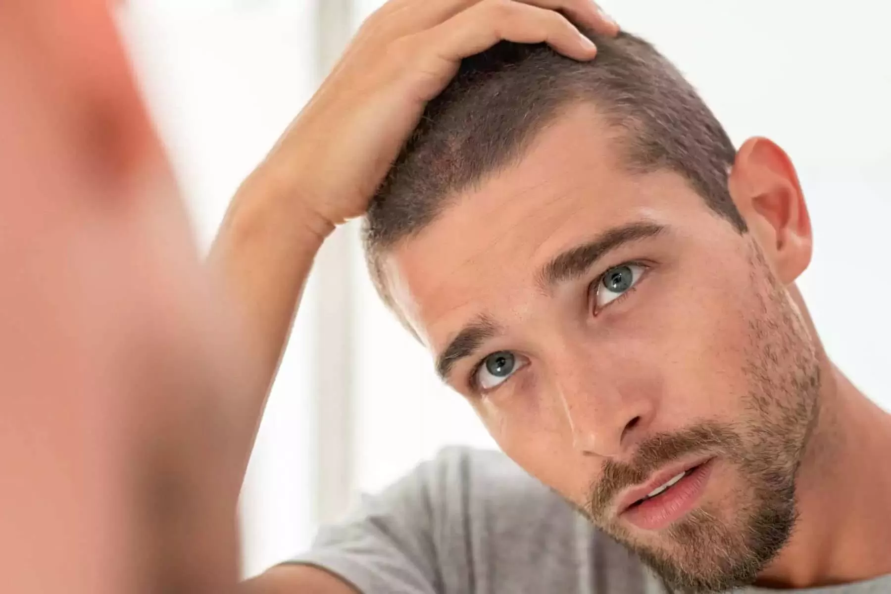 آیا استرس می‌تواند باعث ریزش مو شود؟