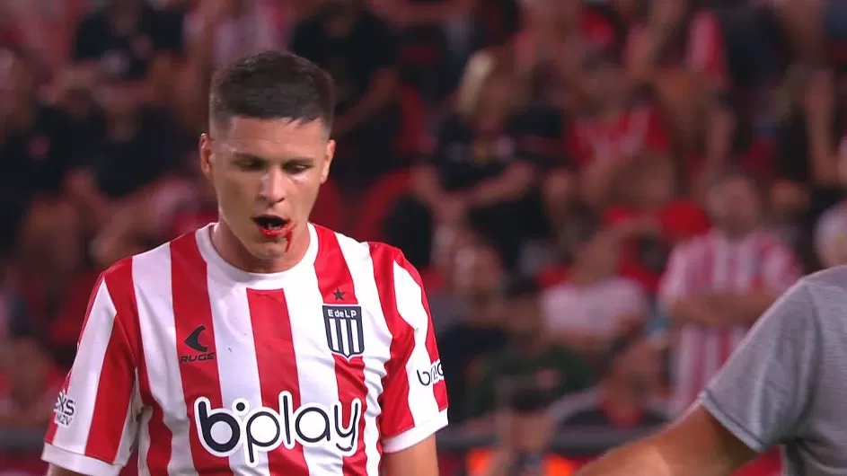 عجایب فوتبال آرژانتین: خرد شدن 3 دندان خطا نیست!