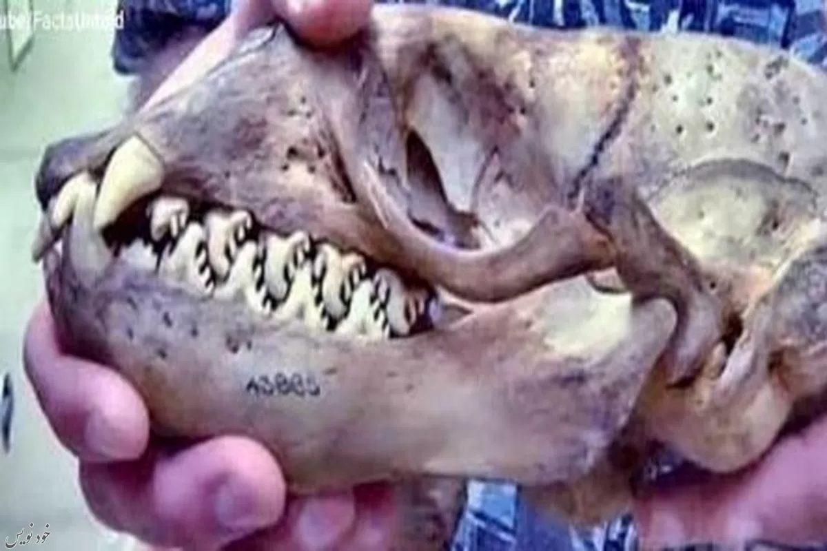 تصویری از نادرترین و عجیب ترین نوع دندان +عکس