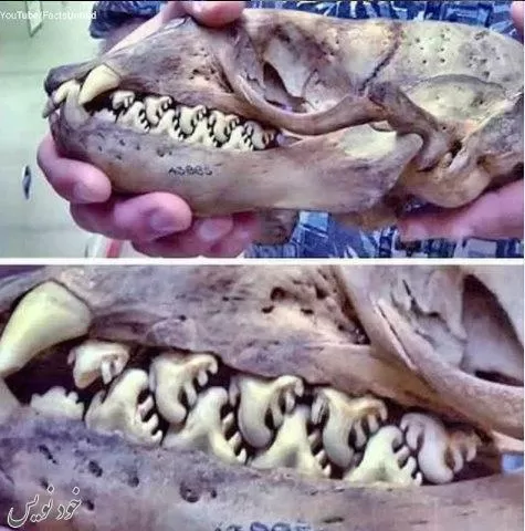 تصویری از نادرترین و عجیب ترین نوع دندان +عکس