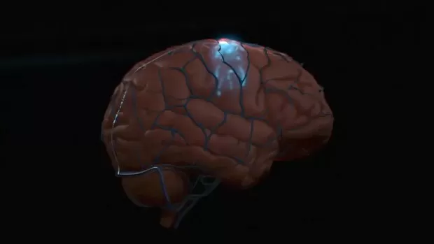 ۴ بیمار فلج با مغزشان رایانه را کنترل کردند! |با کمک یک ایمپلنت اتصال مغز به رایانه 