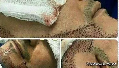 جراحی زیبایی در مردان