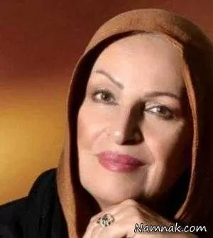 بازیگر زن | جراحی بینی هما خاکپاش بازیگر زن ایرانی