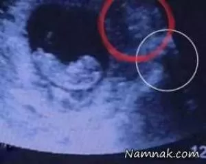 زن باردار | زن بارداری که داخل شکمش یک شیطان دارد!