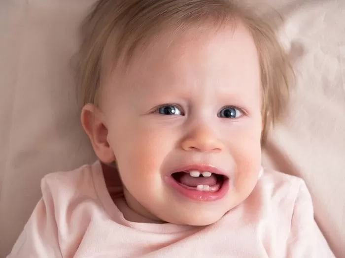 انواع تغییر رنگ دندان کودک