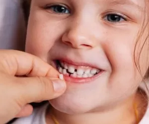 چرا نگهداری دندان شیری مهم است و فواید ان چیست؟