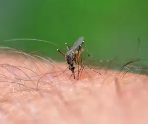 درمان پشه گزیدگی و نیش حشرات با 30 روش سریع خانگی