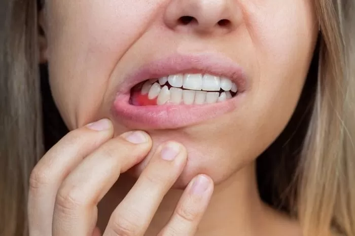 علائم عفونت دندان