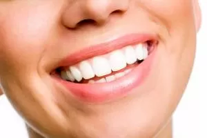 اصلاح طرح لبخند توسط متخصص ارتودنسی