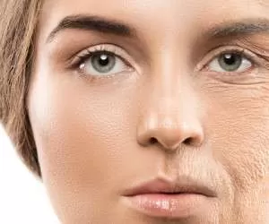 راههای جلوگیری از “افتادگی پوست صورت” و بدن با ماسکهای گیاهی