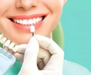 روش صحیح سفید کردن دندان با جوش شیرین + مزایا و معایب