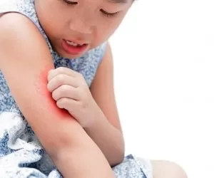علامت انواع آلرژی در کودکان + راه پیشگیری و درمان خانگی