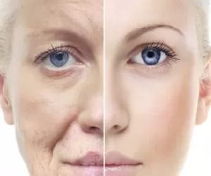پوست صورت چطور و از چه سنی به بعد پیر میشه ؟