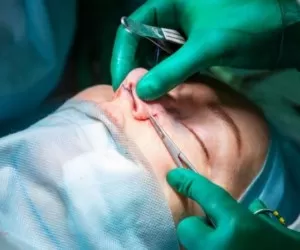 مهم ترین نکاتی که قبل از جراحی بینی باید بدانید