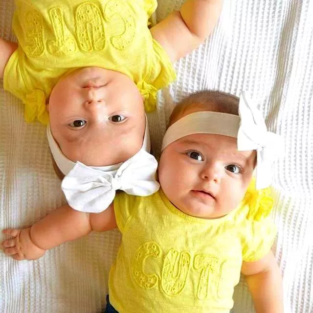 لباس زرد نوزاد