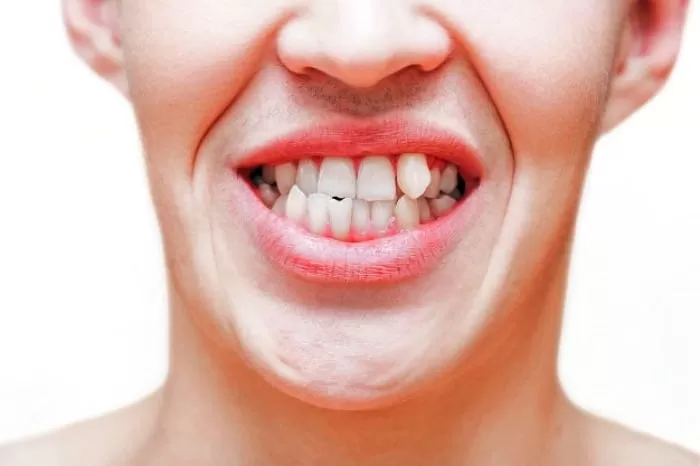 دندان و فرم بدن