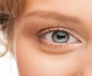 ورم چشم چیست و برای کاهش ورم چشم چه باید کرد؟