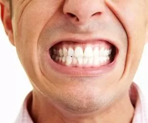 بروکسیم یا دندان قروچه ، از علت تا درمان 