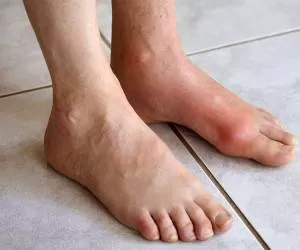 تشخیص بیماری و سلامت بدن از روی ناخن و شکل پا