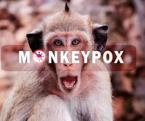 حقیقتی که دیگه همه باید درباره آبله میمونی بدونن