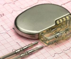 چیزهایی که باید درباره باتری قلب بدانید + نکات انواع باطری قلب