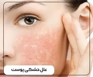 علل خشکی پوست و موثرترین راه های درمان آن