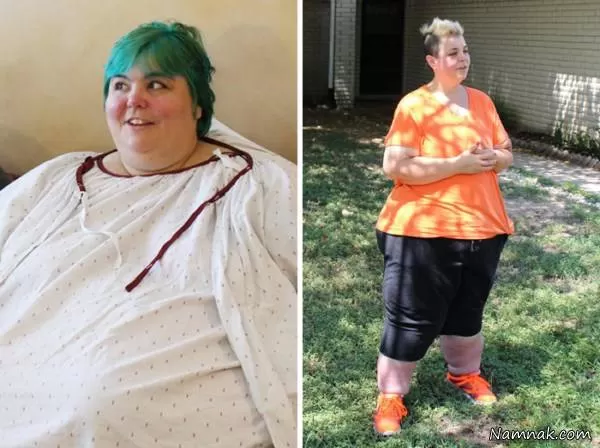 قبل و بعد کاهش وزن