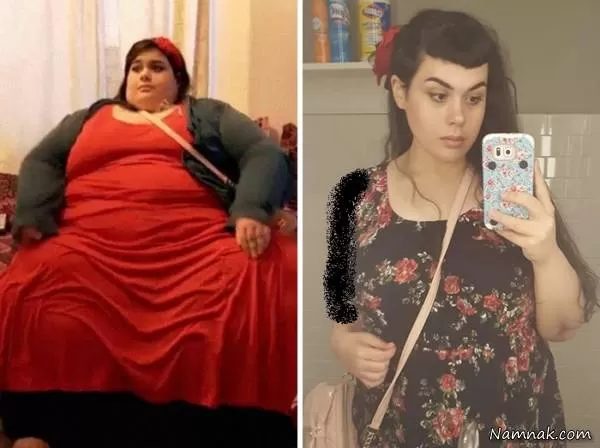 قبل و بعد کاهش وزن