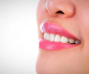 همه چیز درباره کامپوزیت دندان + انواع کامپوزیت و مراقبت از آن
