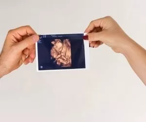 حقایق و خطرات رادیولوژی در بارداری برای جنین