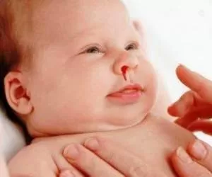 علل خون دماغ نوزاد و کودک خردسال + هشدارها