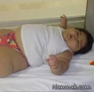پسر بچه چاق 10 ماهه با وزن کودک 9 ساله! + تصاویر