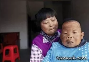 بیماری نادر مرد 30 ساله چینی هم قد کودک 2 ساله + تصاویر