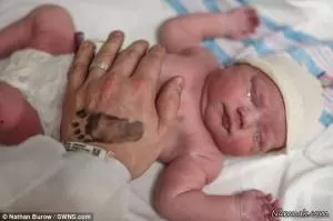 تولد عجیب نوزادی که سرش داخل کیسه بود !! + تصاویر 16+