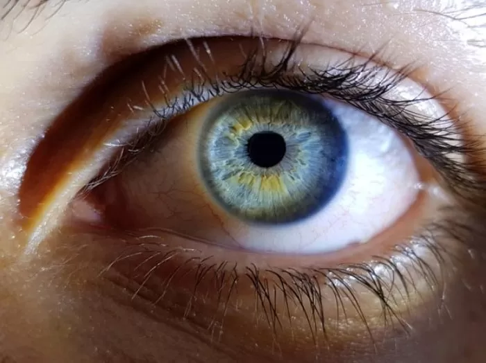 بیماری شبکیه چشم