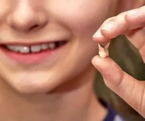 آنچه والدین از دندان شیری کودکان باید بدانند + نکات مراقبت
