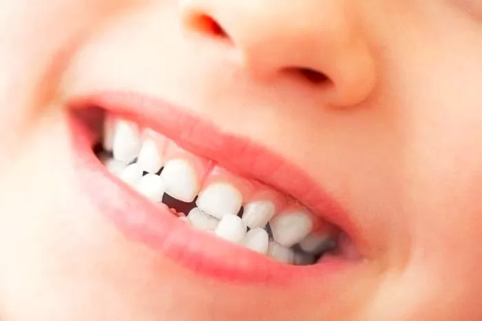 دندان لق کودک