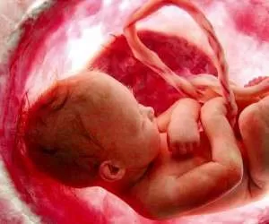 وقتی سقط جنین قصاص دارد + مجازات سقط برای پدر و مادر