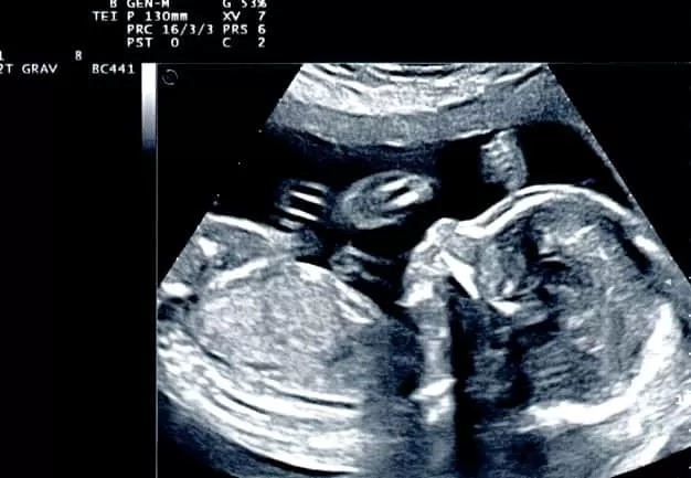  وضعیت جنین در هفته 26 بارداری