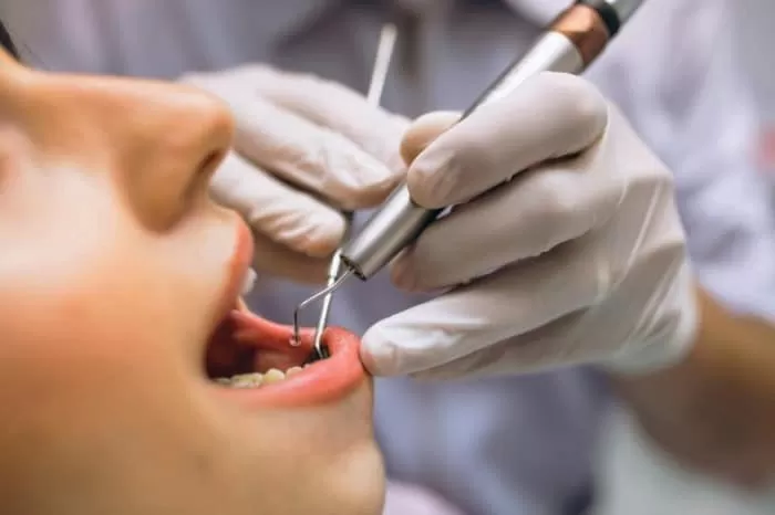  عوارض جرمگیری دندان