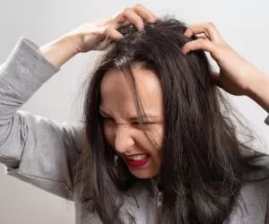 درمان شپش موی سر با شامپو لیندان