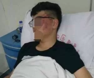 کتک زدن شدید دانش آموز توسط معلم چینی