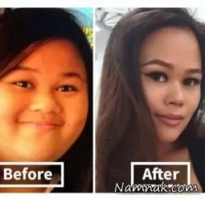 عکسهای جالب از صورت ها قبل و بعد لاغری 