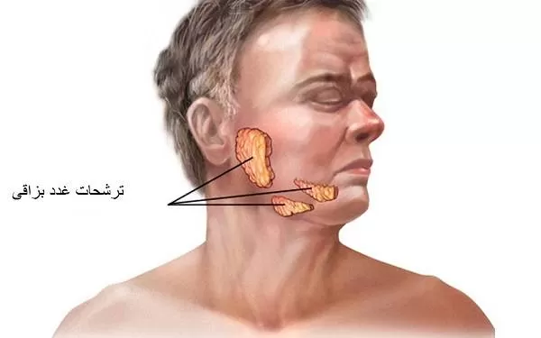  ترشحات غدد بزاقی