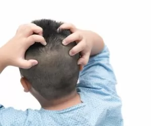 علل و علائم اگزما پوست سر + درمان آن در کودکان و بزرگسالان