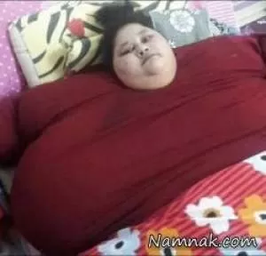 زن 500 کیلویی 250 کیلو لاغر شد + تصاویر